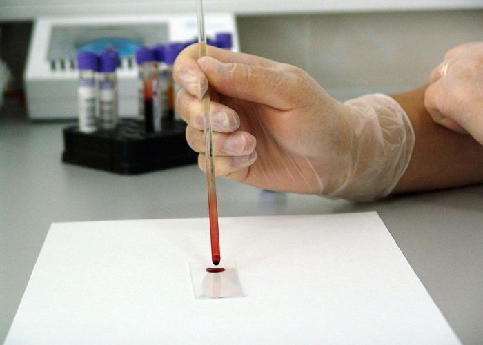 '1 ธ.ค. วันเอดส์โลก' กรมวิทย์ฯ ร่วมศึกษาวิจัยเพื่อยุติปัญหาการติดเชื้อเอชไอวีในไทย