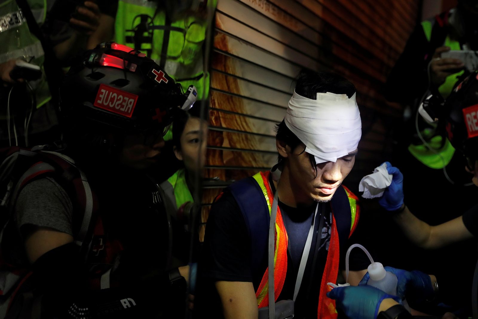 Reuters-ผู้สื่อข่าวได้รับบาดเจ็บจากกระสุนยางในการประท้วงฮ่องกง.JPG