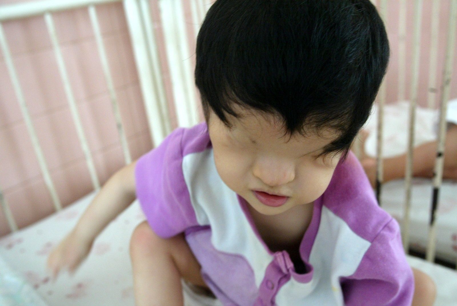 AFP-เด็กที่ได้รับผลกระทบจากฝนเหลือ agent orange.JPG