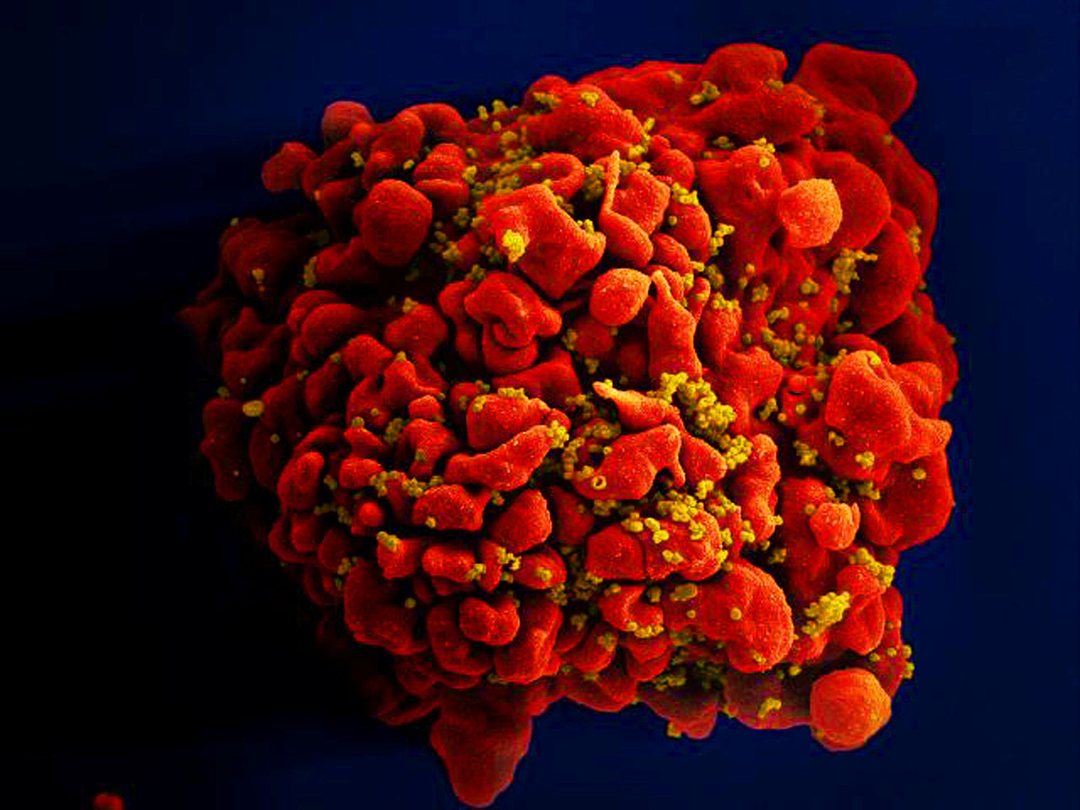 Reuters - HIV เอชไอวี เอดส์ ไวรัส