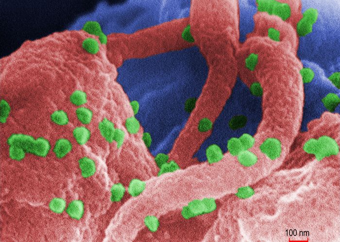 ​โลกพบผู้ติดเชื้อไวรัส HIV คนที่ 2 หายเองได้โดยไม่ได้รับการรักษา