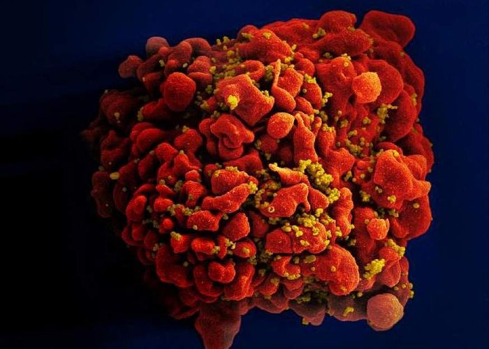 นักวิทย์แยก HIV ออกจากเซลส์ ใช้เทคโนโลยีดัดแปลงยีนรางวัลโนเบล
