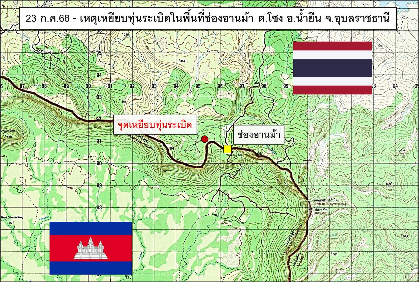 ช่องอานม้า