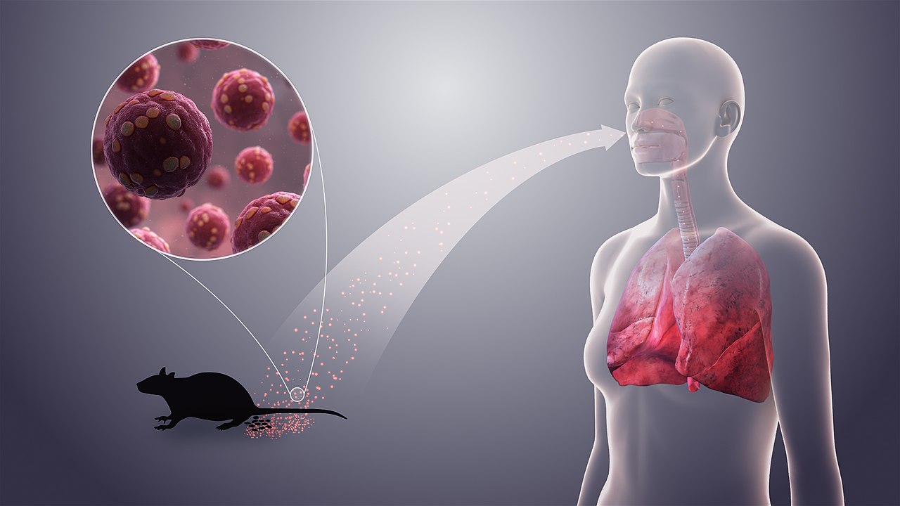 1280px-Hantavirus.jpg